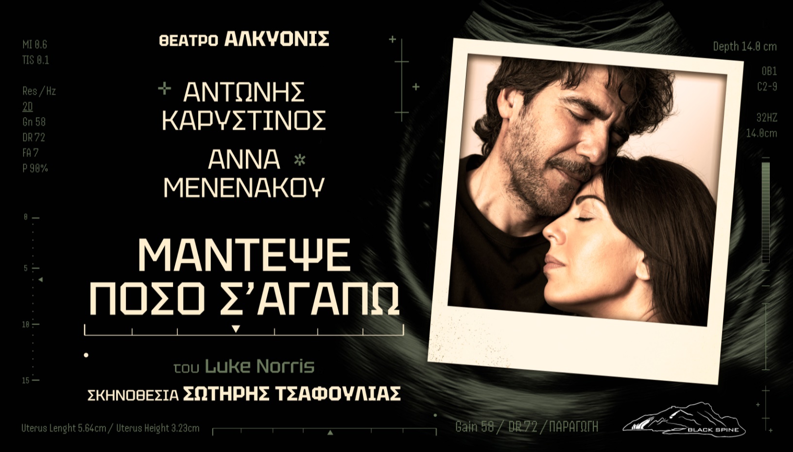 ΜΑΝΤΕΨΕ ΠΟΣΟ Σ